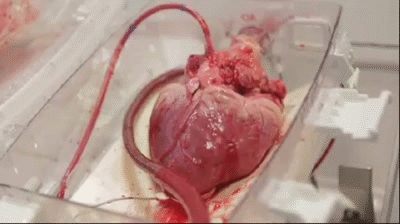 Human Heart For Sale