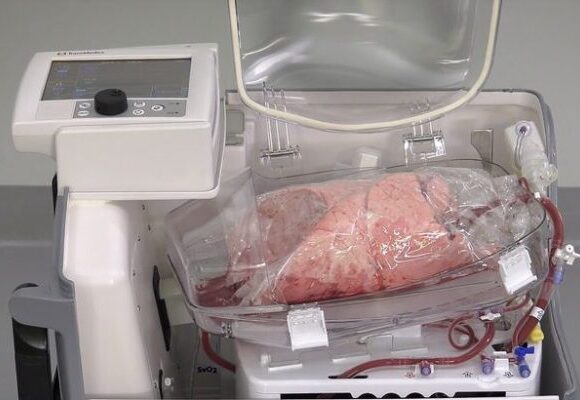 Human Lungs for Sale 600x400 1 580x400