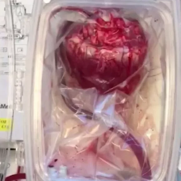 live heart 1 580x580