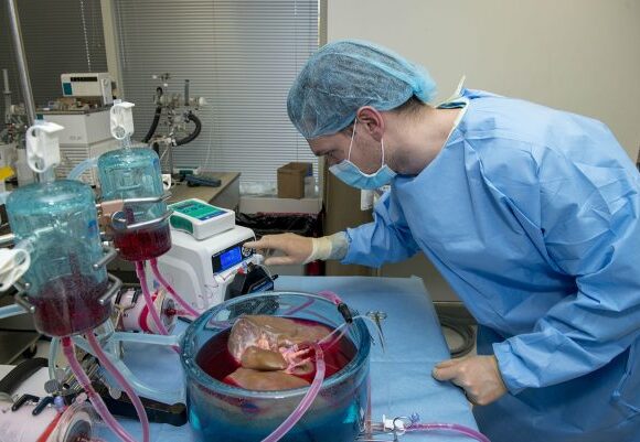 liver 600x401 1 580x401